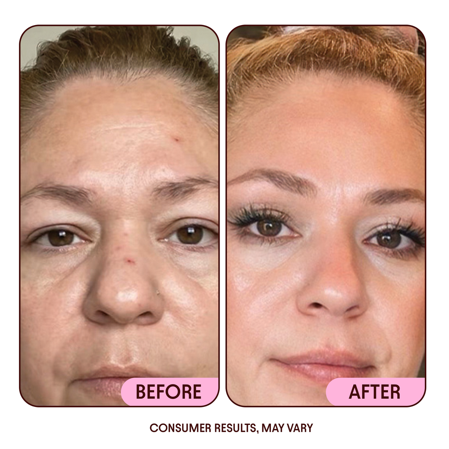 Hydra Glow |Crema hidratante anti-edad